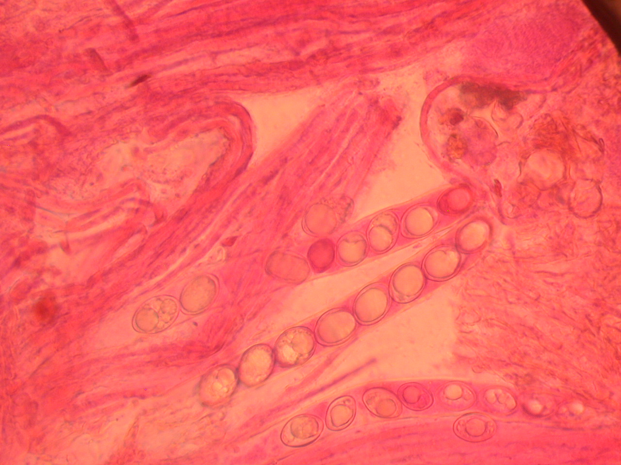 Tarzetta catinus